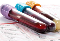 Что анализ крови может рассказать о работе организма?