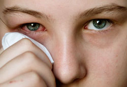 Основные симптомы глазного герпеса