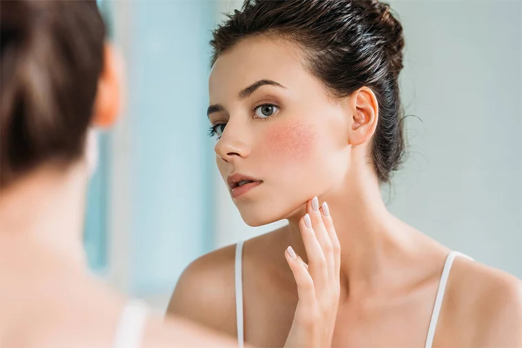 Правильный уход за чувствительной кожей лица: 10 советов дерматологов
